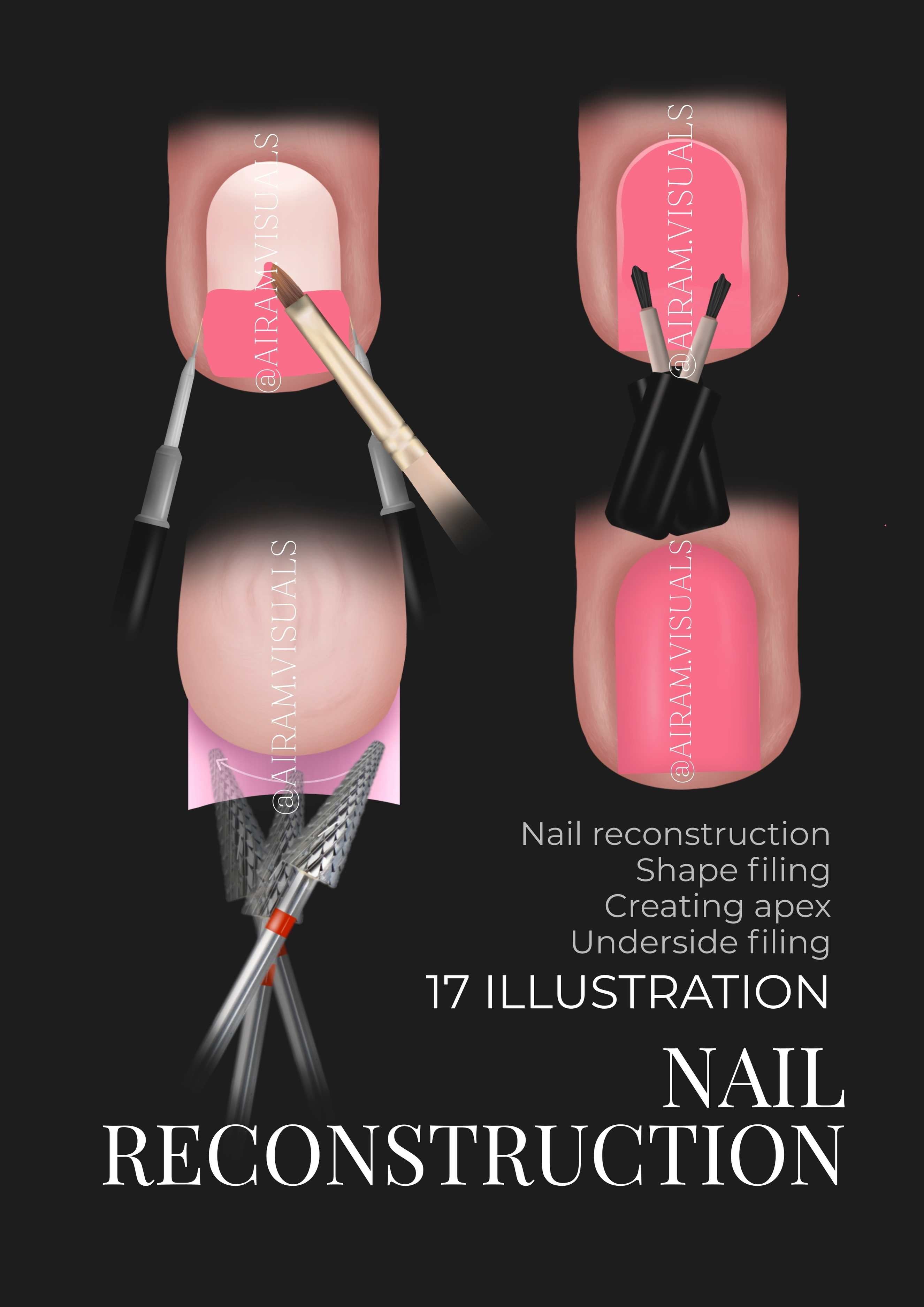 Protezarea unghiei scurte - 17 ilustrații