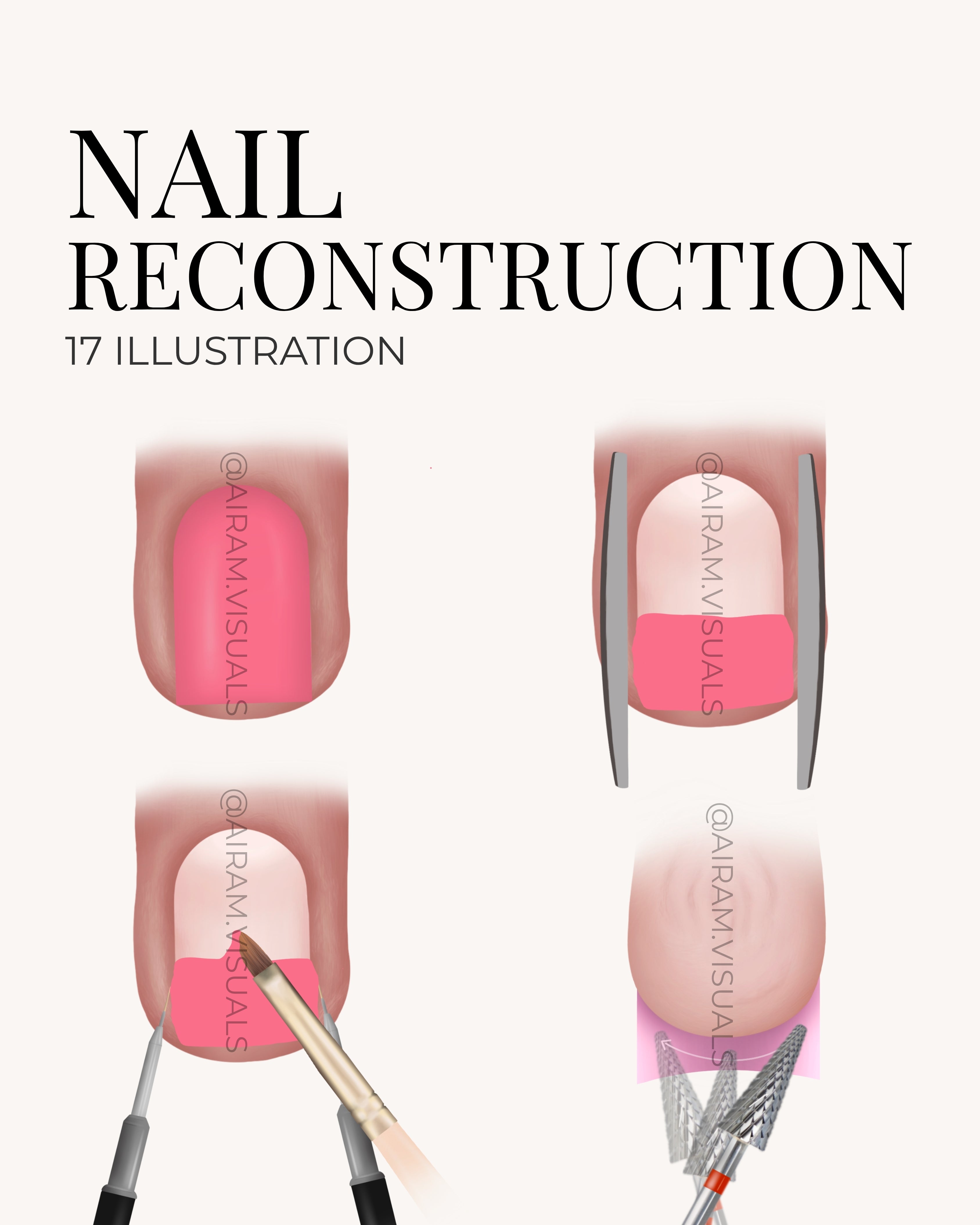 Protezarea unghiei scurte - 17 ilustrații