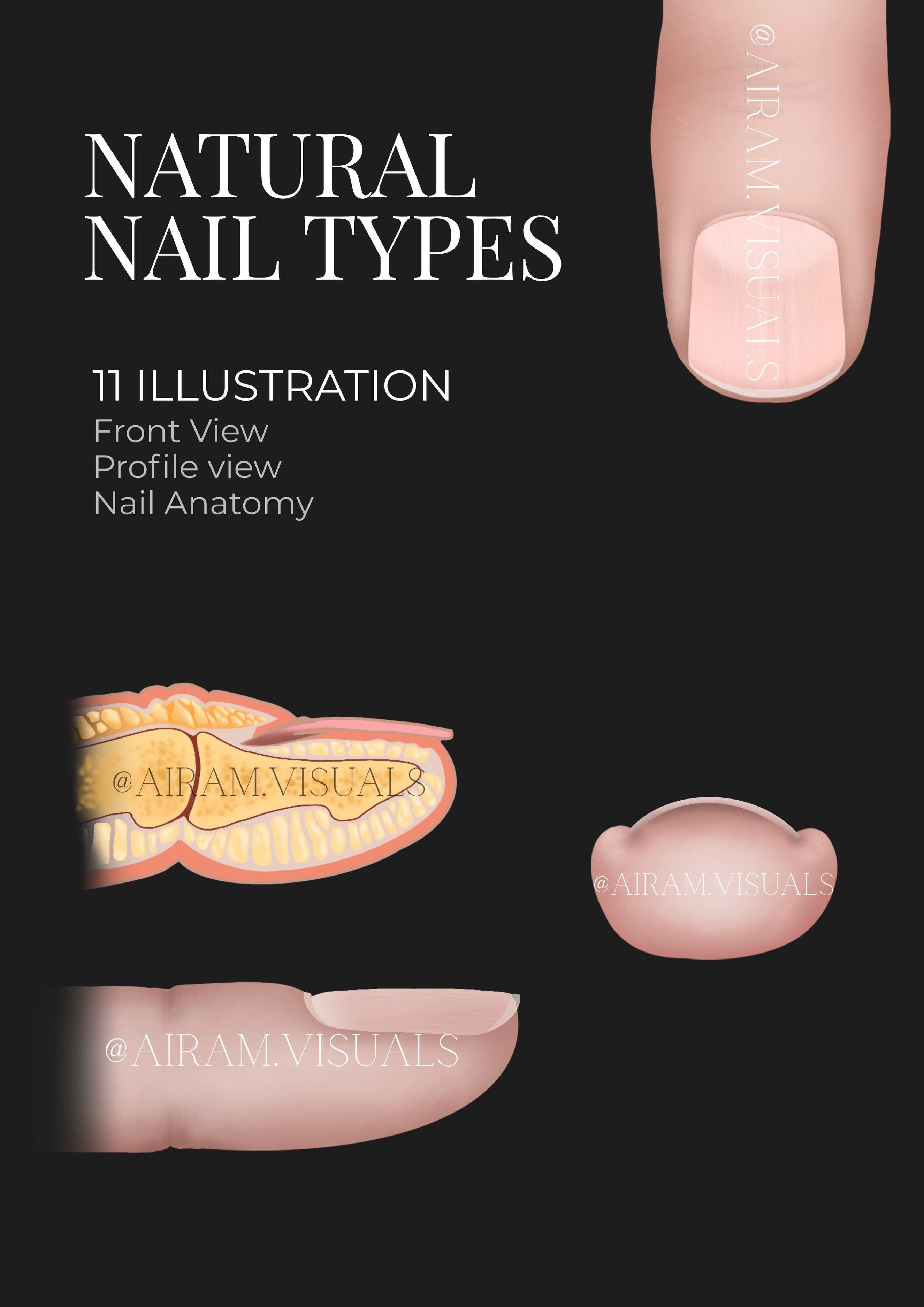 Tipuri de Pat Unghial & Anatomie - 11 ilustratii